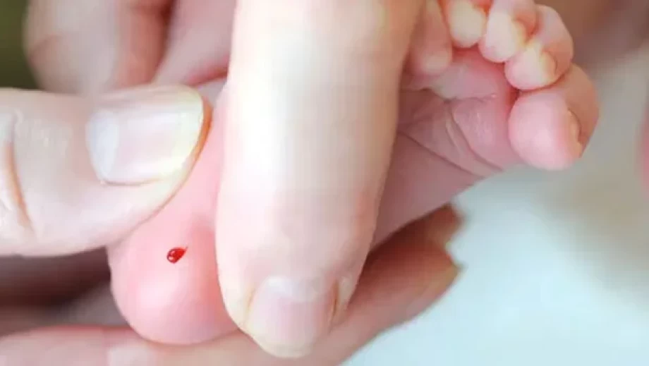 ضرورت غربالگری نوزادان در روزهای نخست زندگی